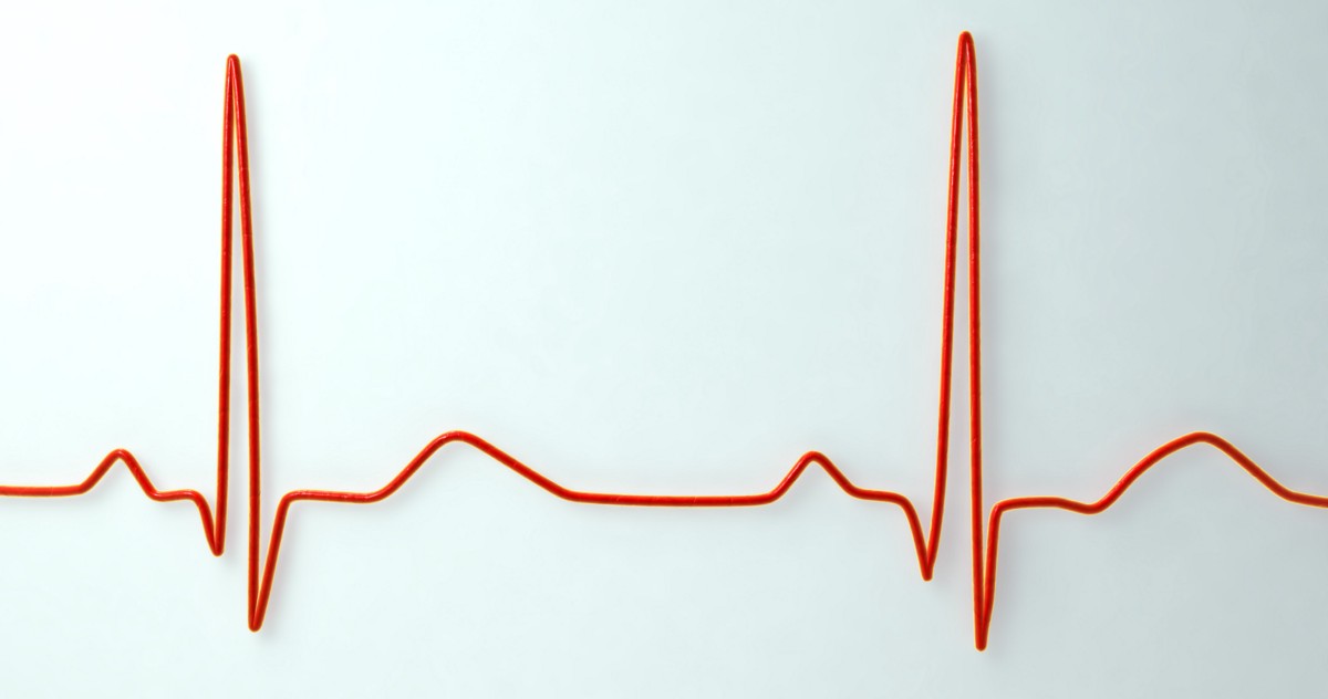 What Your Resting Heart Rate Tells You About Your Health