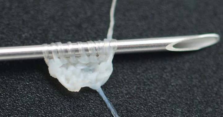 Creepy crochet: Physicians grow human ‘skin yarn’ for sewing up cuts