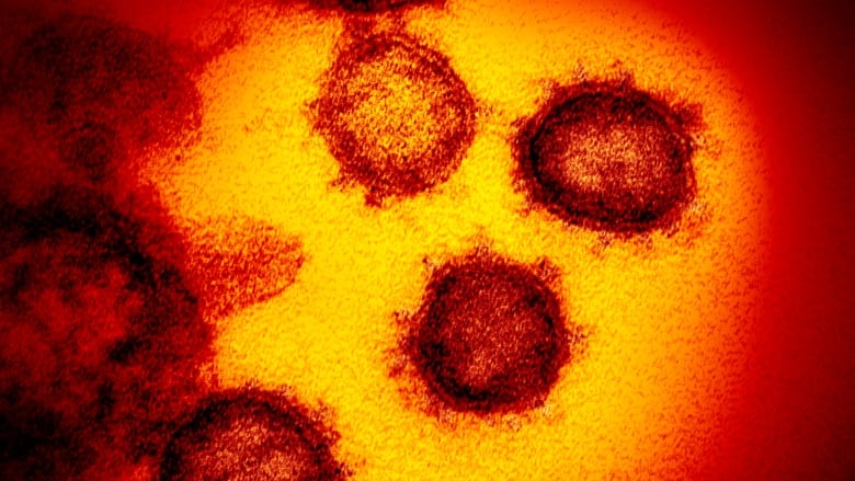 Ontario confirms 3 new positive cases of coronavirus | CBC News