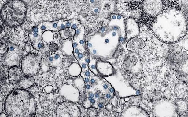 COVID-19 | India yet to share genome sequence data