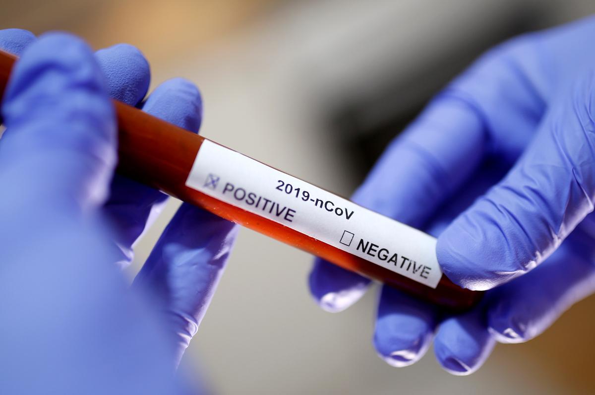 Laboratories meet with White House, kind consortium for coronavirus tests