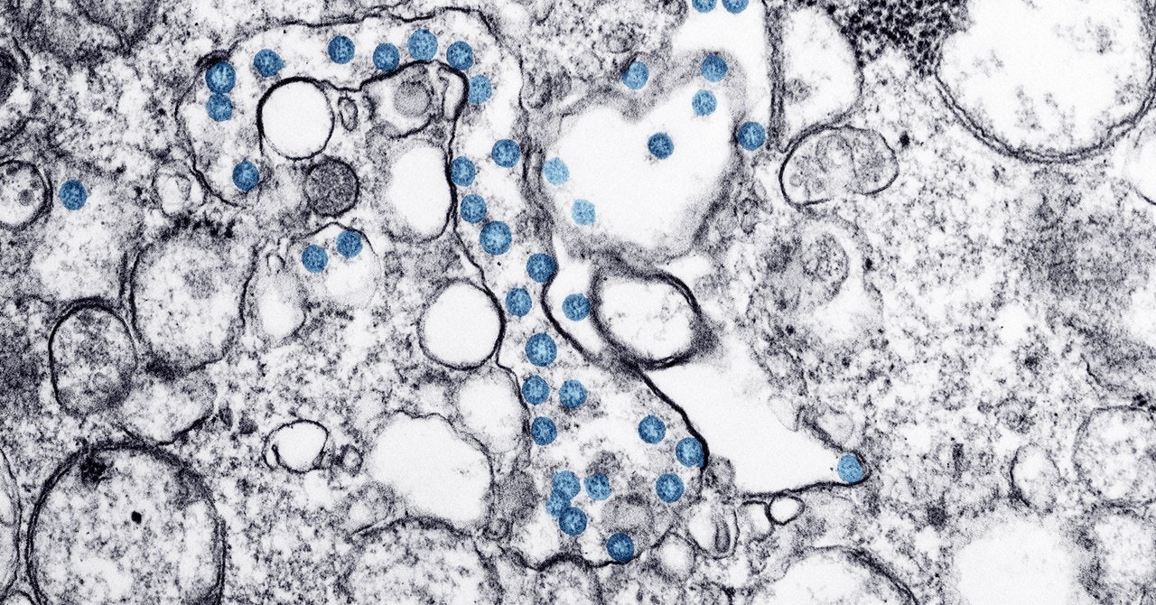 For how long Does the Coronavirus Last on Surface Areas?