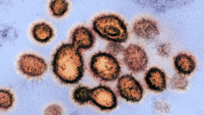 Metal, plastic, cardboard: How long does coronavirus last on surface areas?