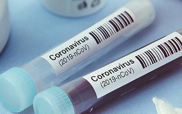 Coronavirus | IIT-Delhi team develops cheap COVID-19 test