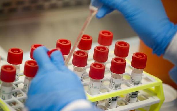 4 ICMR labs to end up being approval centres for test packages