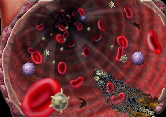 Coronavirus patients in Houston hospital becoming first in US to try speculative plasma transfusion