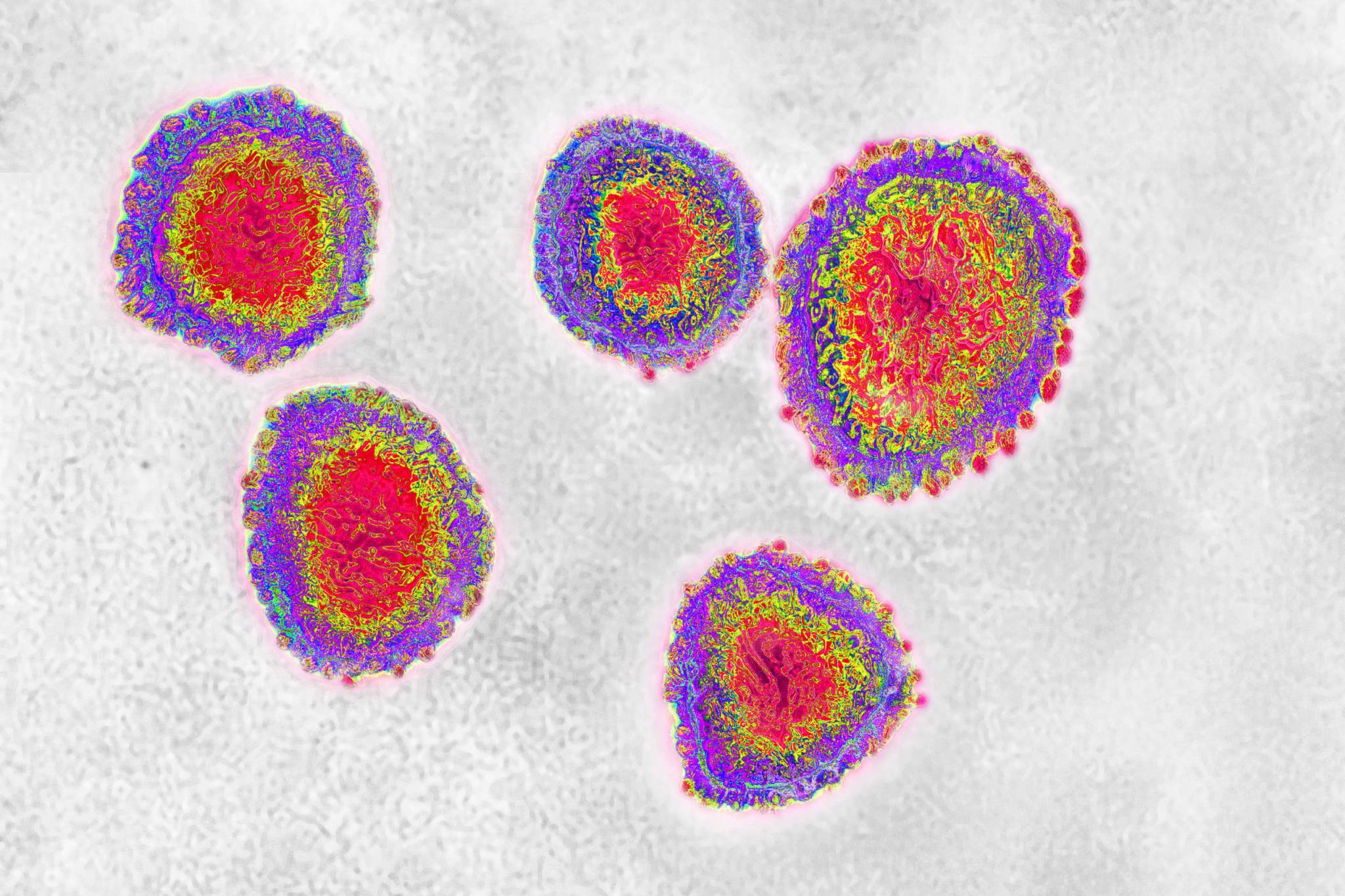 COVID-19 testing: TPG’s Brian Kelly got a second coronavirus antibody test with very different outcomes