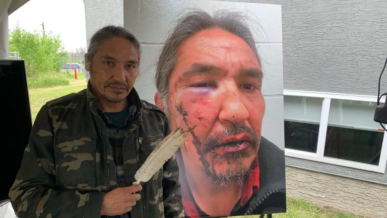 Investigation launched after northern Alberta chief accuses RCMP of assault | CBC News