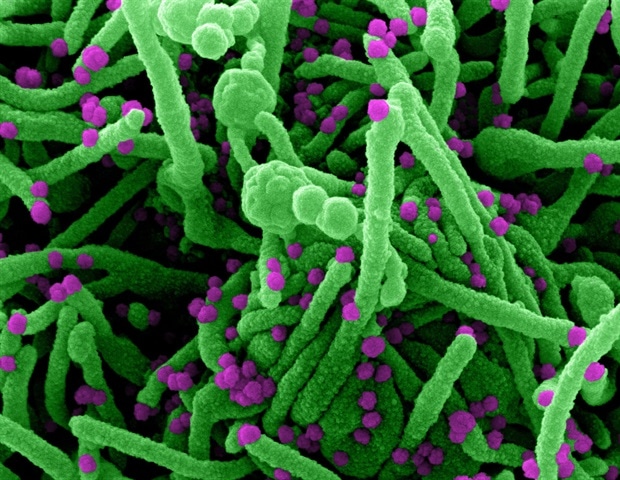 Specific immune signature recognized in COVID-19 patients -Medical.Net