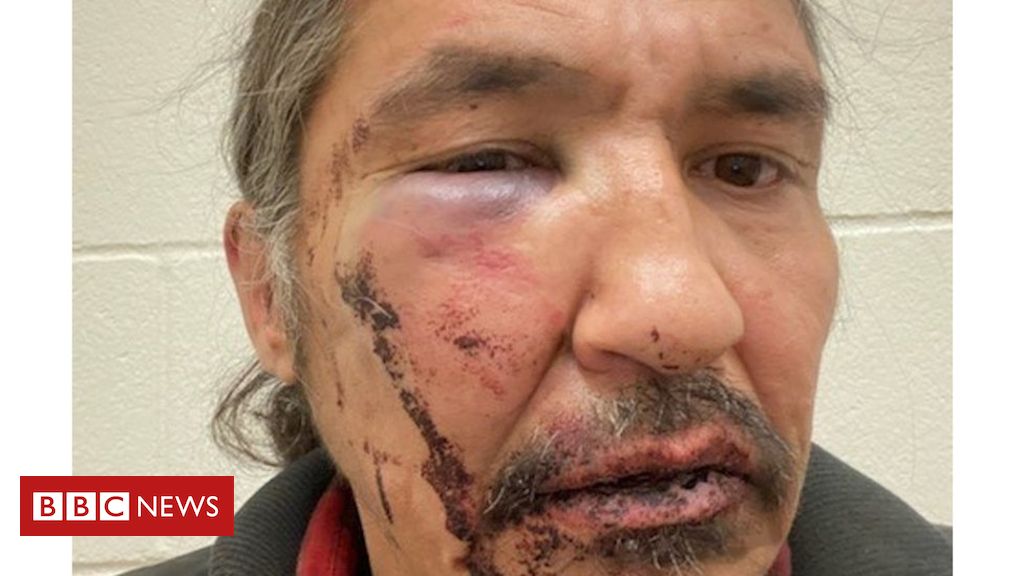 Canada Indigenous chief damaged throughout arrest