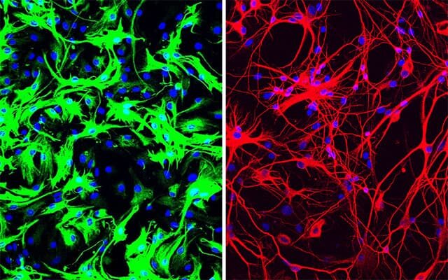 One-time treatment generates new nerve cells, gets rid of Parkinson’s illness in mice