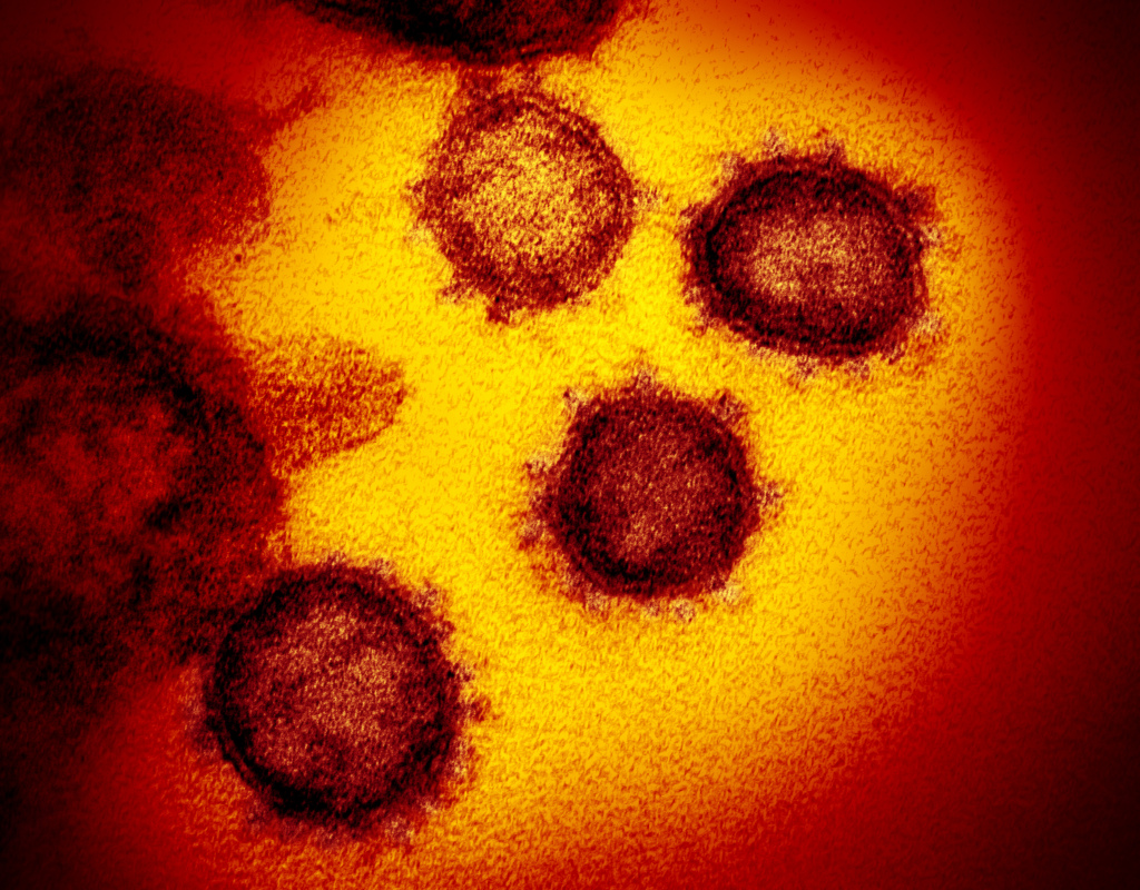 Coronavirus: Why don’t people get sick?