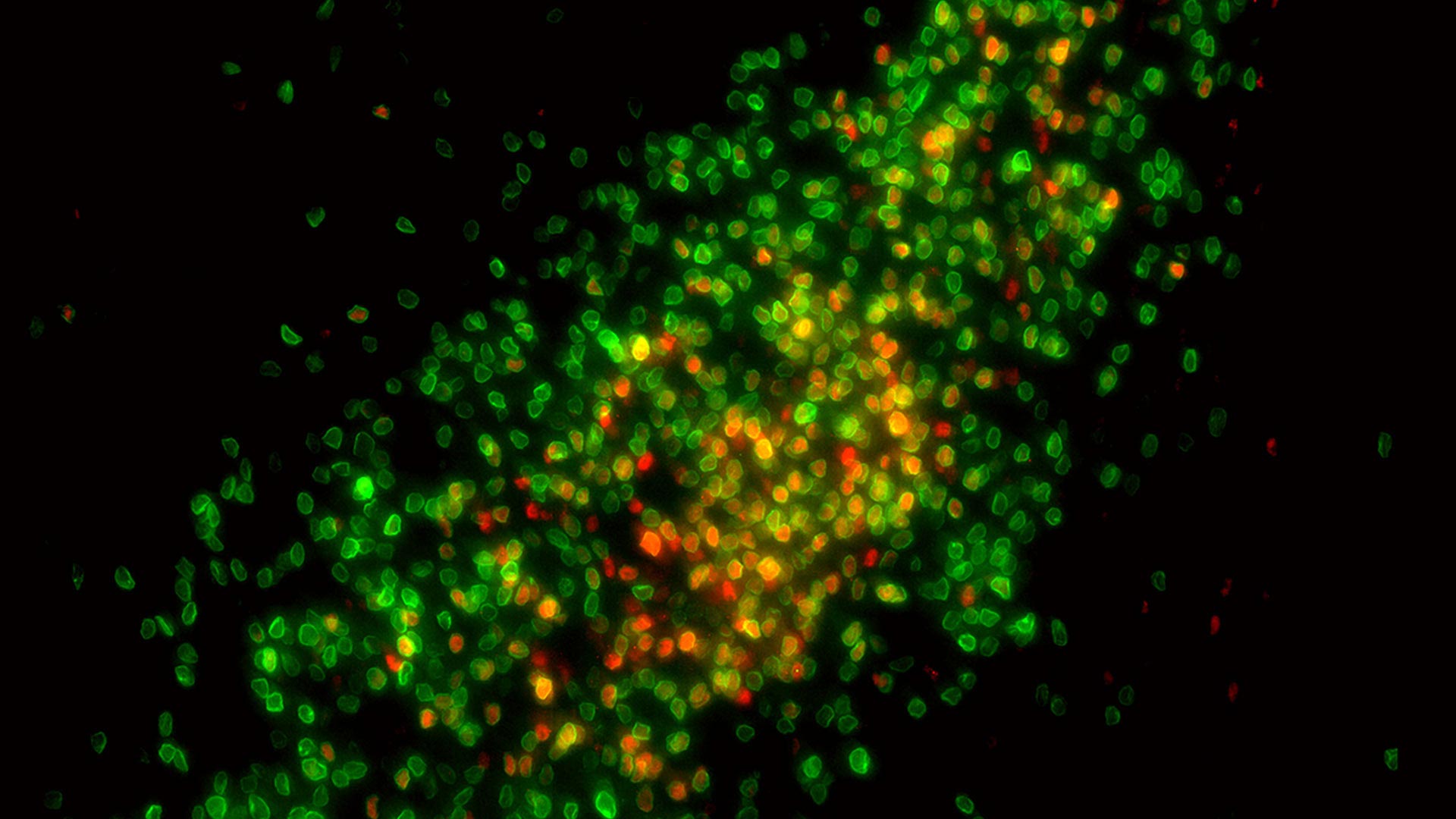 Scientists Glimpse How Intercourse Hormones Clarify Mind Differences Between Males and Ladies folks