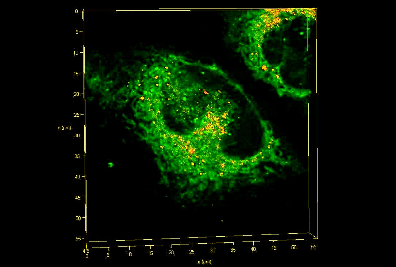 Stress Can Be Lawful – Unusual Clues to Doing away with Develop-Up of Toxic Proteins in Dementia