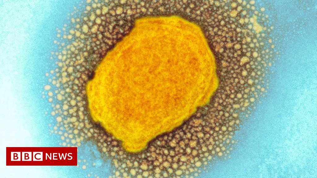 Monkeypox case confirmed in England