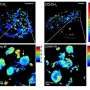 Researchers amplify hidden natural structures by combining SRS and enlargement microscopy