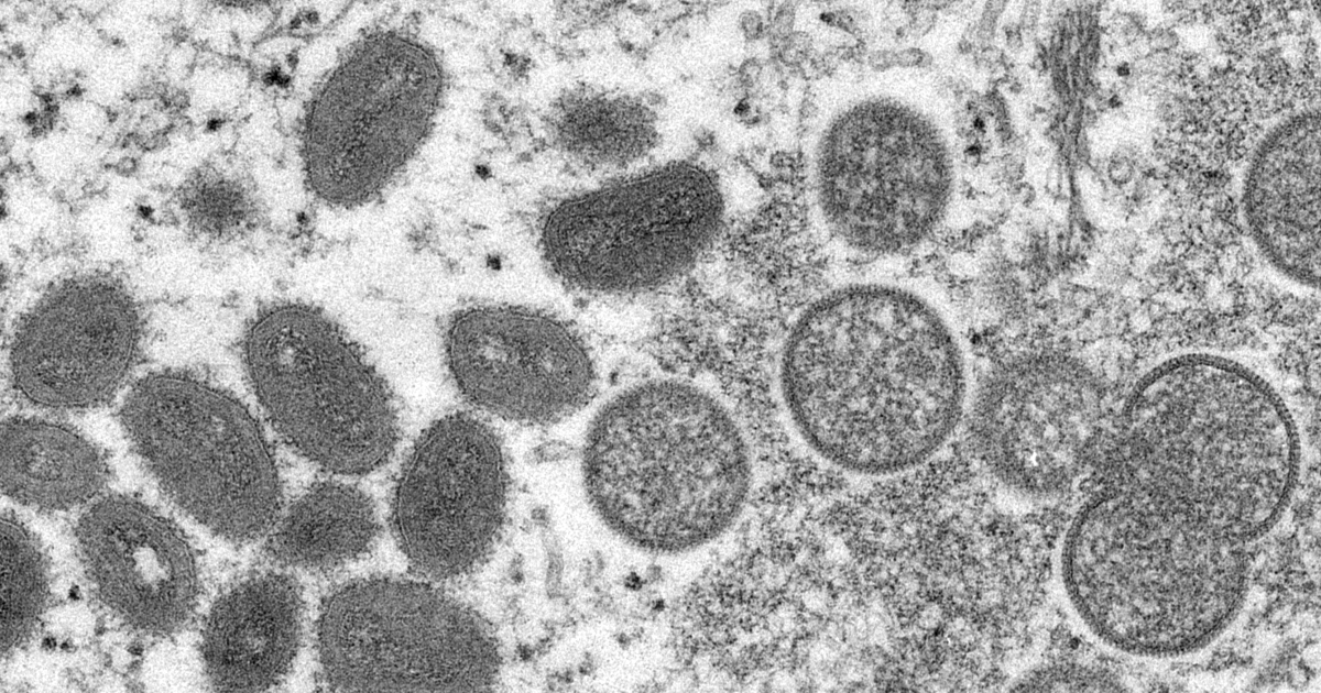 France, Germany, Belgium characterize first monkeypox virus cases