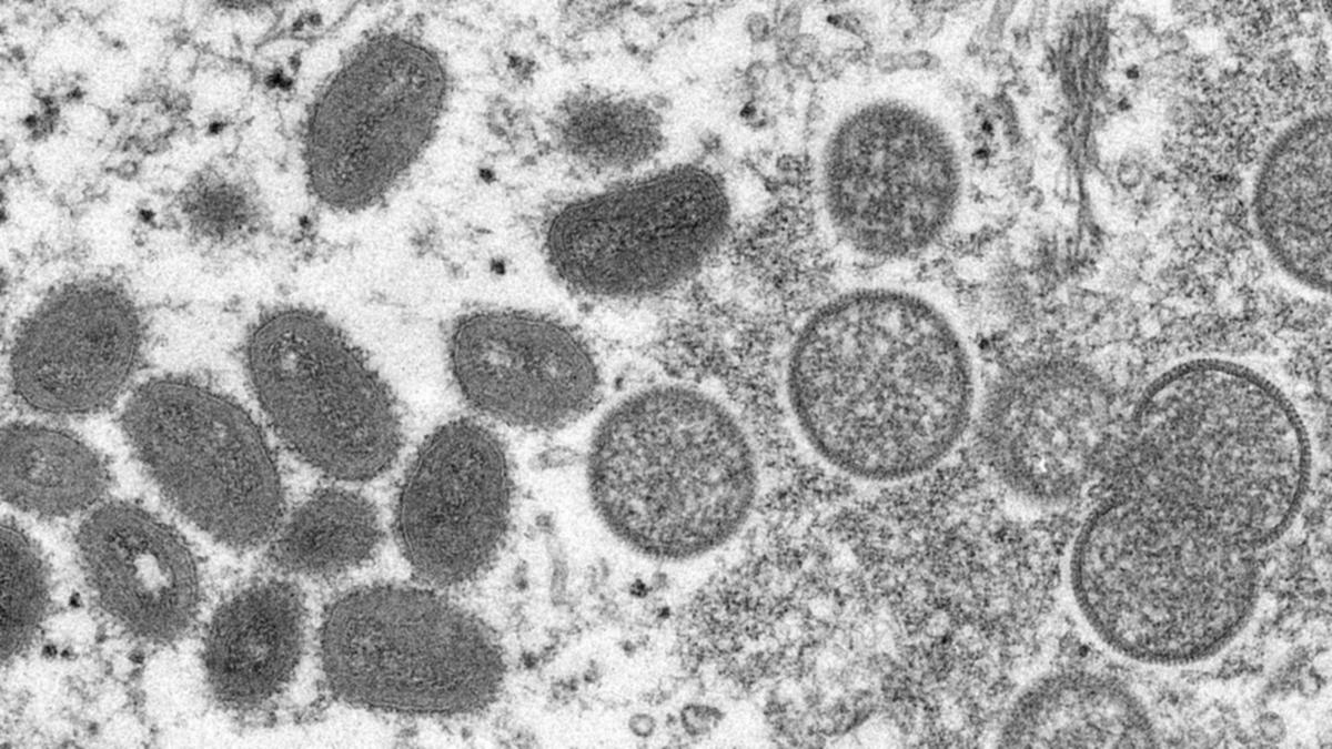 What’s monkeypox? A microbiologist explains what we know about the smallpox cousin