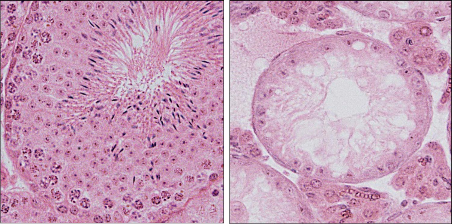 Shedding Light on Sperm Pattern Failure Triggered by Testicular Warming