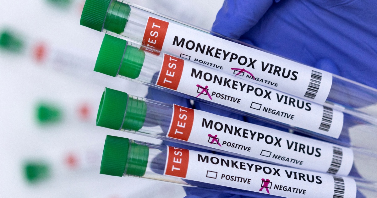 Monkeypox has seemingly spread undetected ‘for some time’: WHO