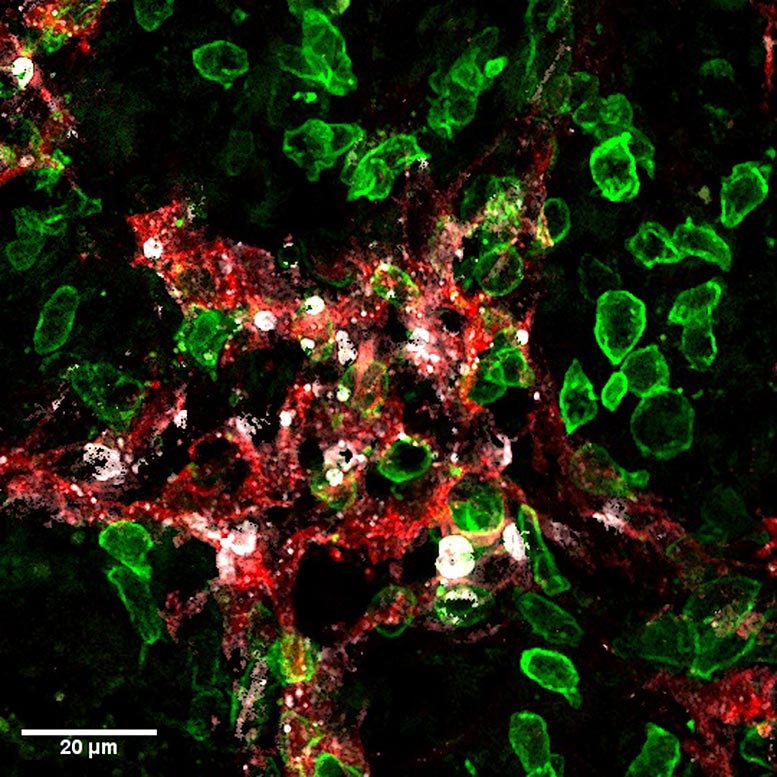 The Double Excellent thing about Killer T-Cells To Stop Most cancers Metastases