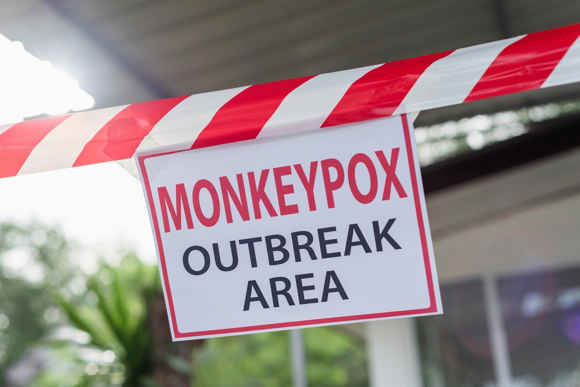 Infectious Illness Expert: What You Might perhaps presumably perhaps also merely smooth Know Referring to the Current Monkeypox Outbreak