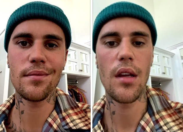 Justin Bieber littered with partial face paralysis introduced about by Ramsay Hunt Syndrome