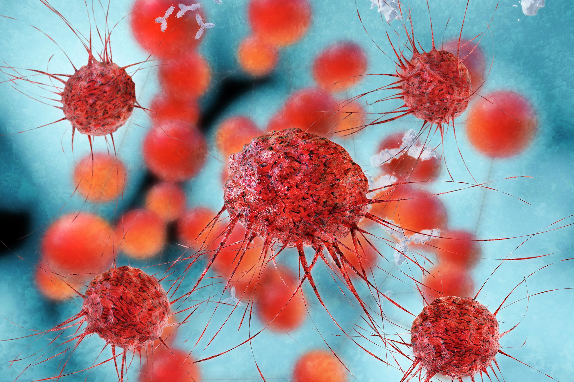 Fresh Treatment Shrinks Cancer in 80% of Patients