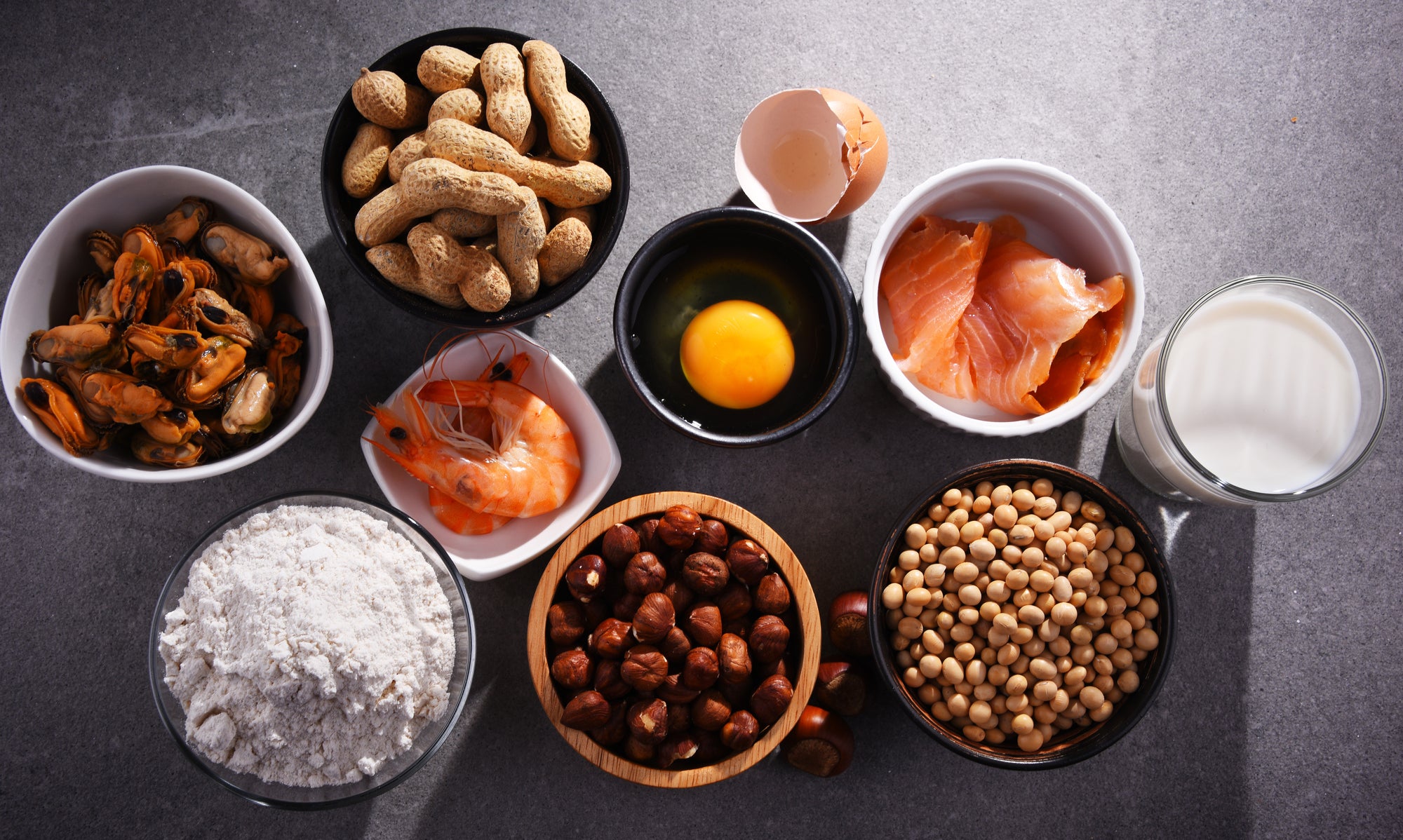 It’s more challenging for youths with food allergy symptoms to snatch COVID
