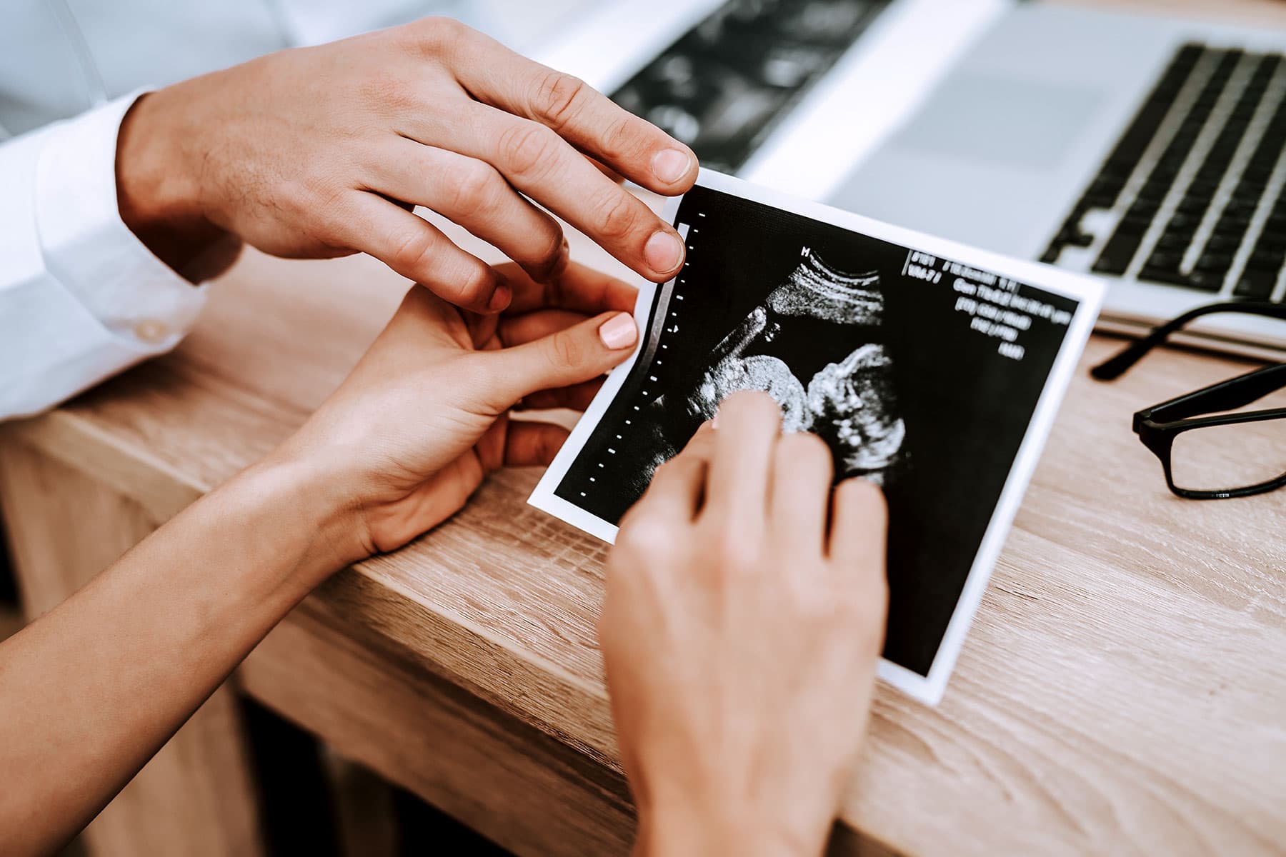 Extra Dismal Mothers Ship by Cesarean, Not Continuously by Different