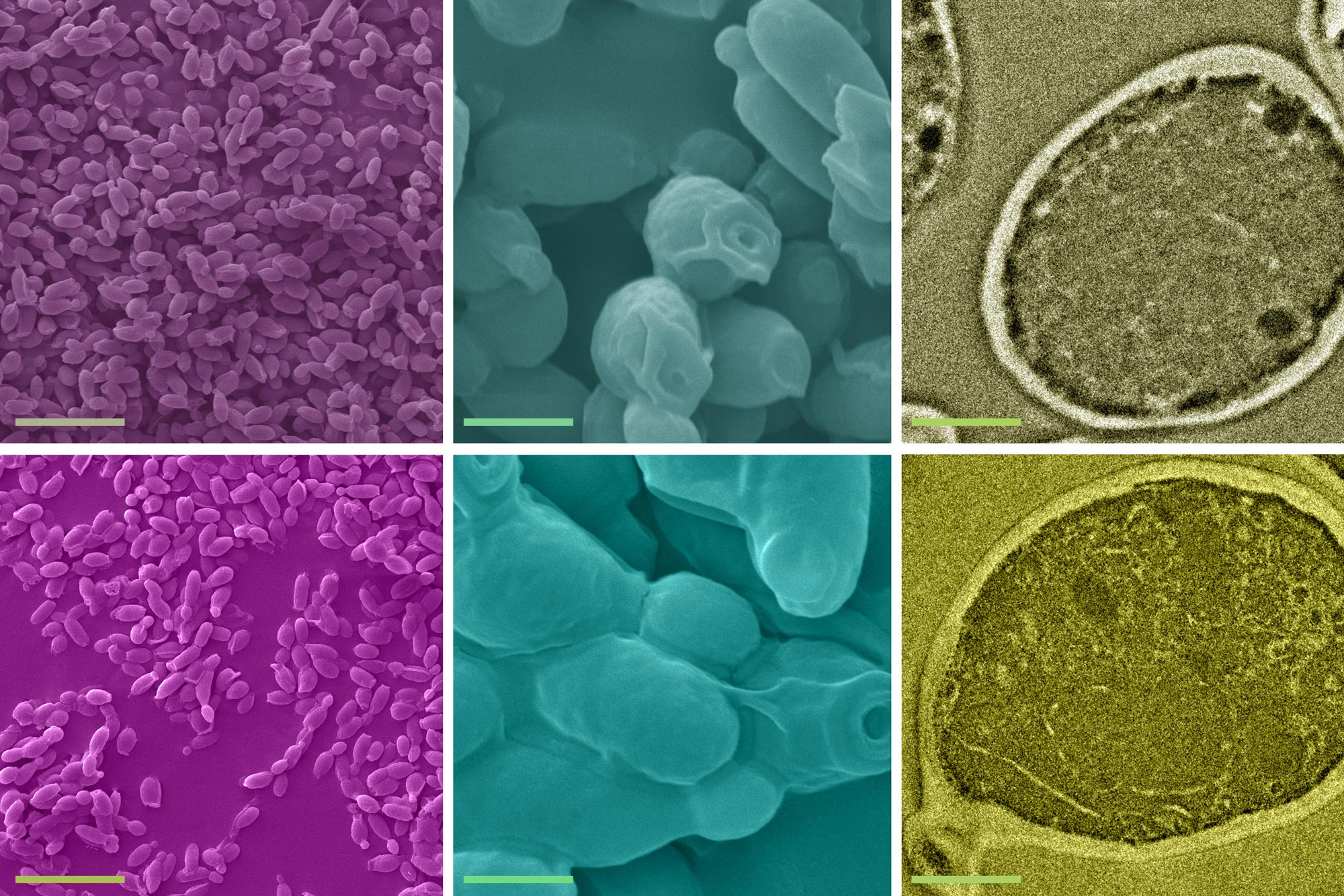 Ragged Beer Yeast Could additionally Be Straightforward Procedure to Heavy Metal Contamination in Water