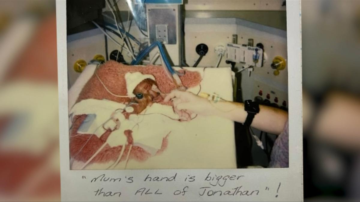 Bear in mind the ‘Coke can child’? He’s about to celebrate a outstanding milestone