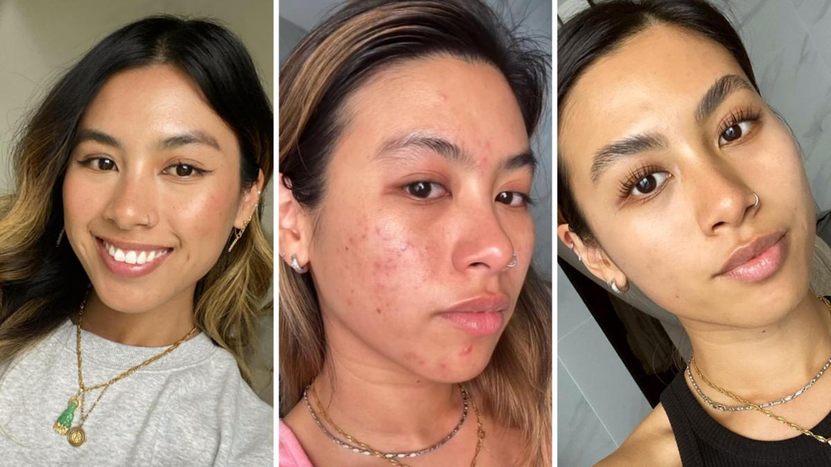 Carbon Theory: Makeup artist Thanh Vo swears by $11.99 facial cleansing bar for clearing up her skin in a single month