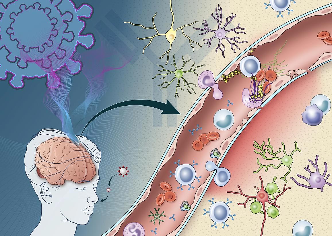 Published: How Immune Response Attributable to COVID-19 May perchance perchance perhaps Ruin the Mind