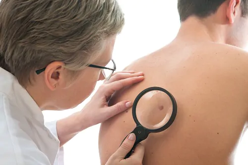 Atlas de Dermatologia: Nevo Melanocítico Congênito e Disidrose chegaram na categoria