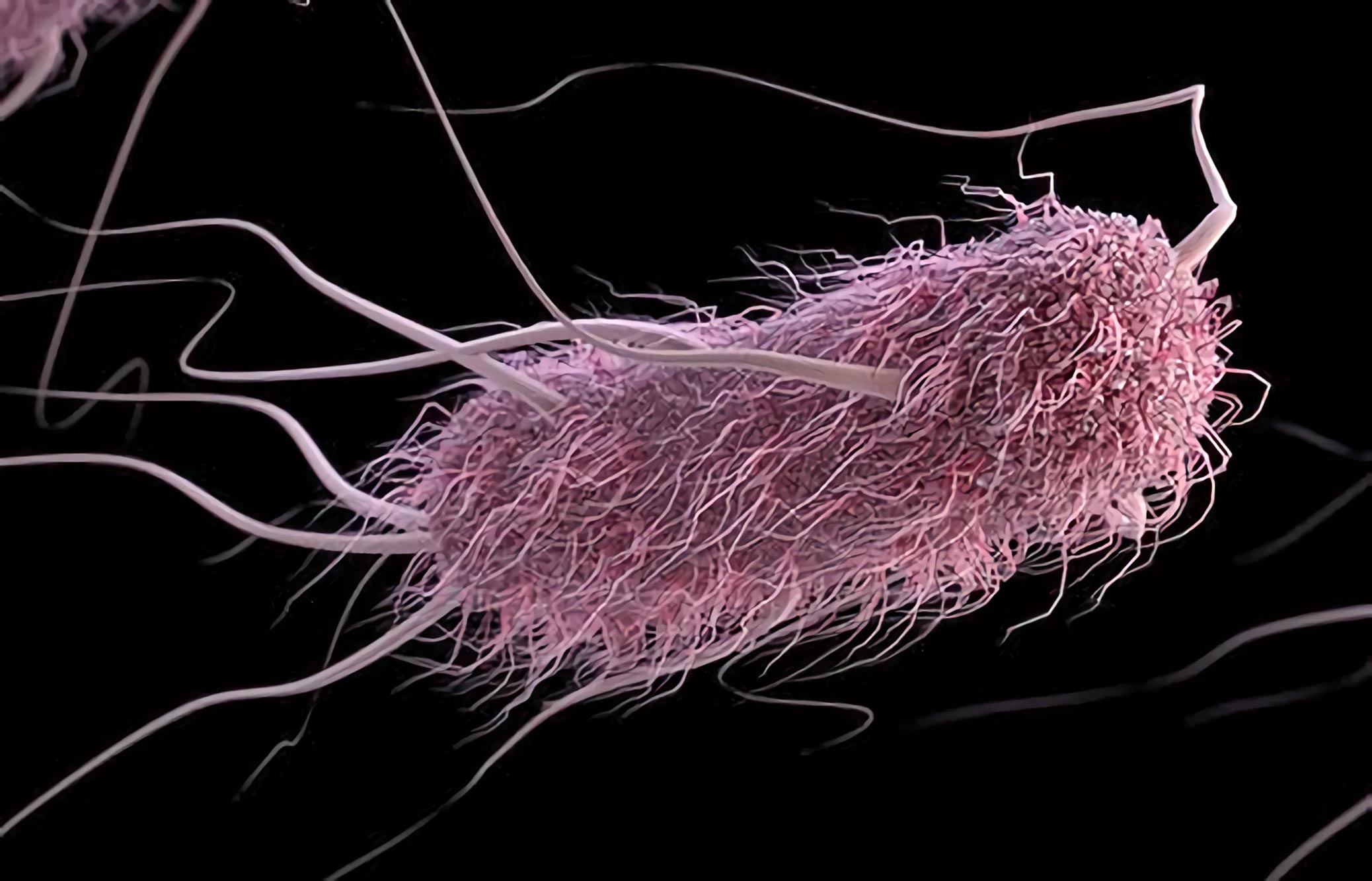 Genetically Engineered, Sound-Controlled Bacteria That Explore and Extinguish Cancer Cells