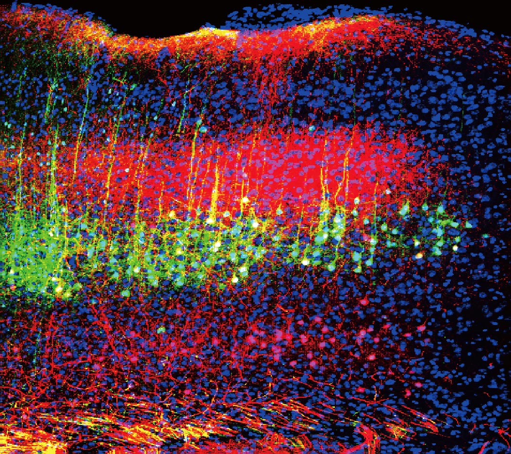 Chronic Anguish Relief Through Sound: Newly Known Brain Circuits Could Show Higher Anguish Therapies