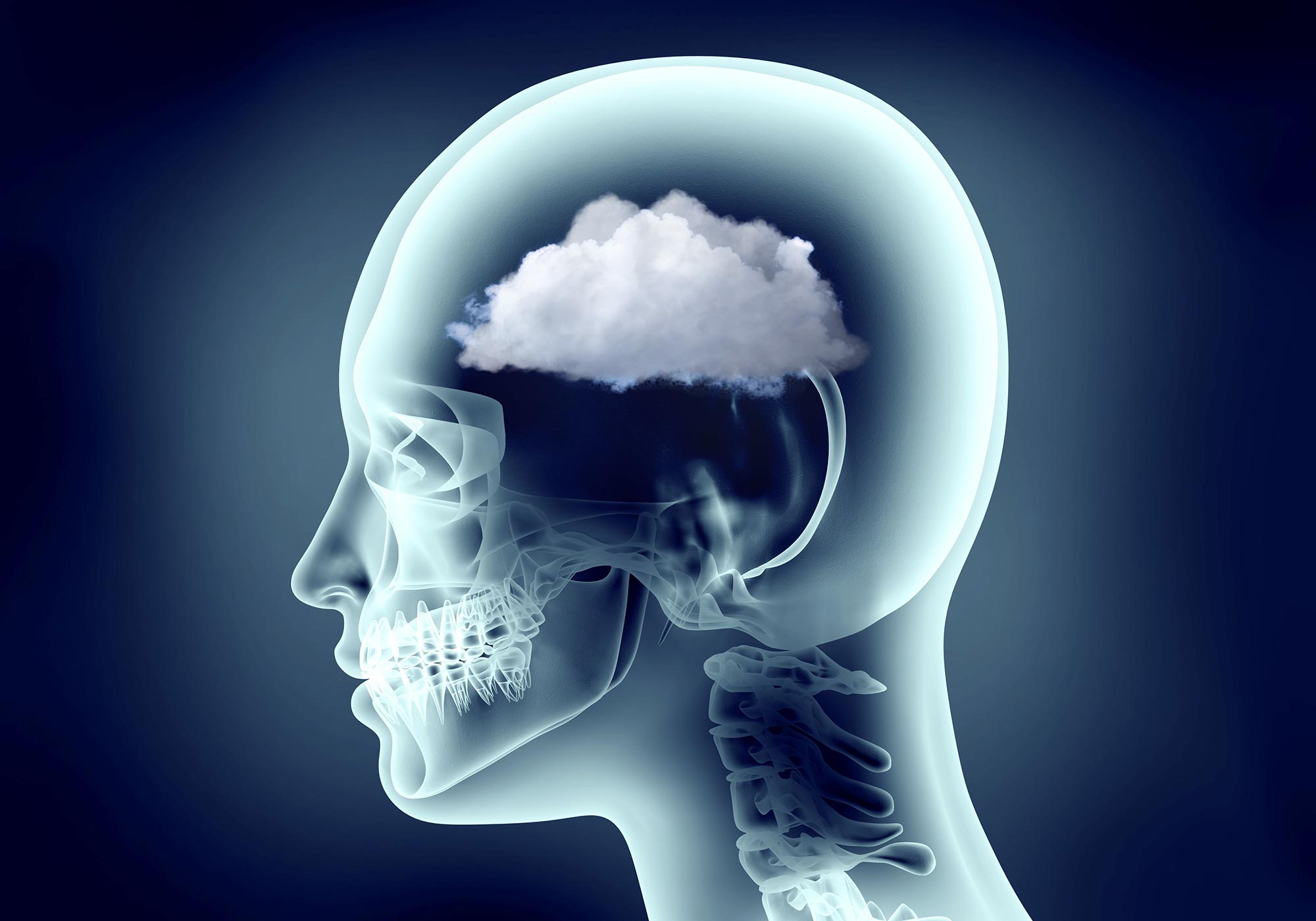 Feeling Foggy? What Is Mind Fog and How Can You Secure Rid of It?