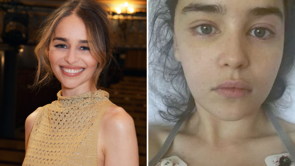 Sport of Thrones important person Emilia Clarke foremost scientific disaster published: ‘There’s reasonably loads lacking’