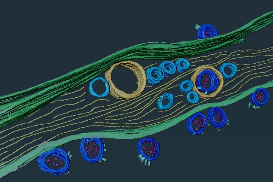 Coronavirus might per chance well enter the brain by building miniature tunnels from the nose