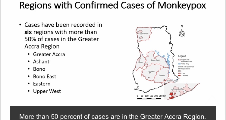 Greater Accra has extra than 50% of monkeypox cases