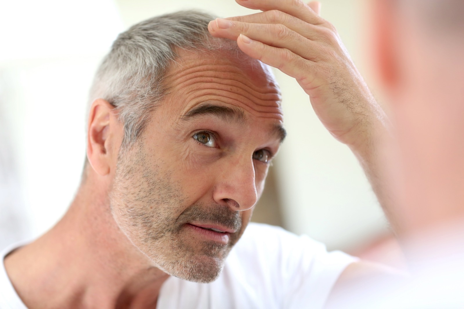 The important thing to a permanent treatment for baldness can had been found