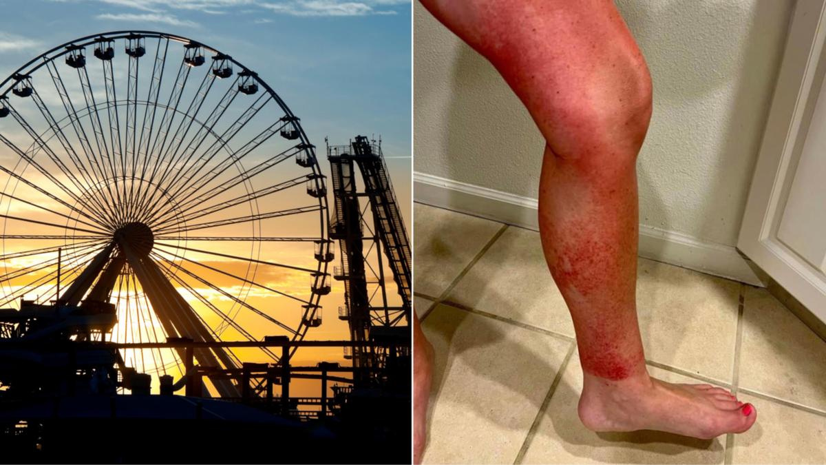 New warning to amusement park fans over annoying fresh ‘Disney Rash’