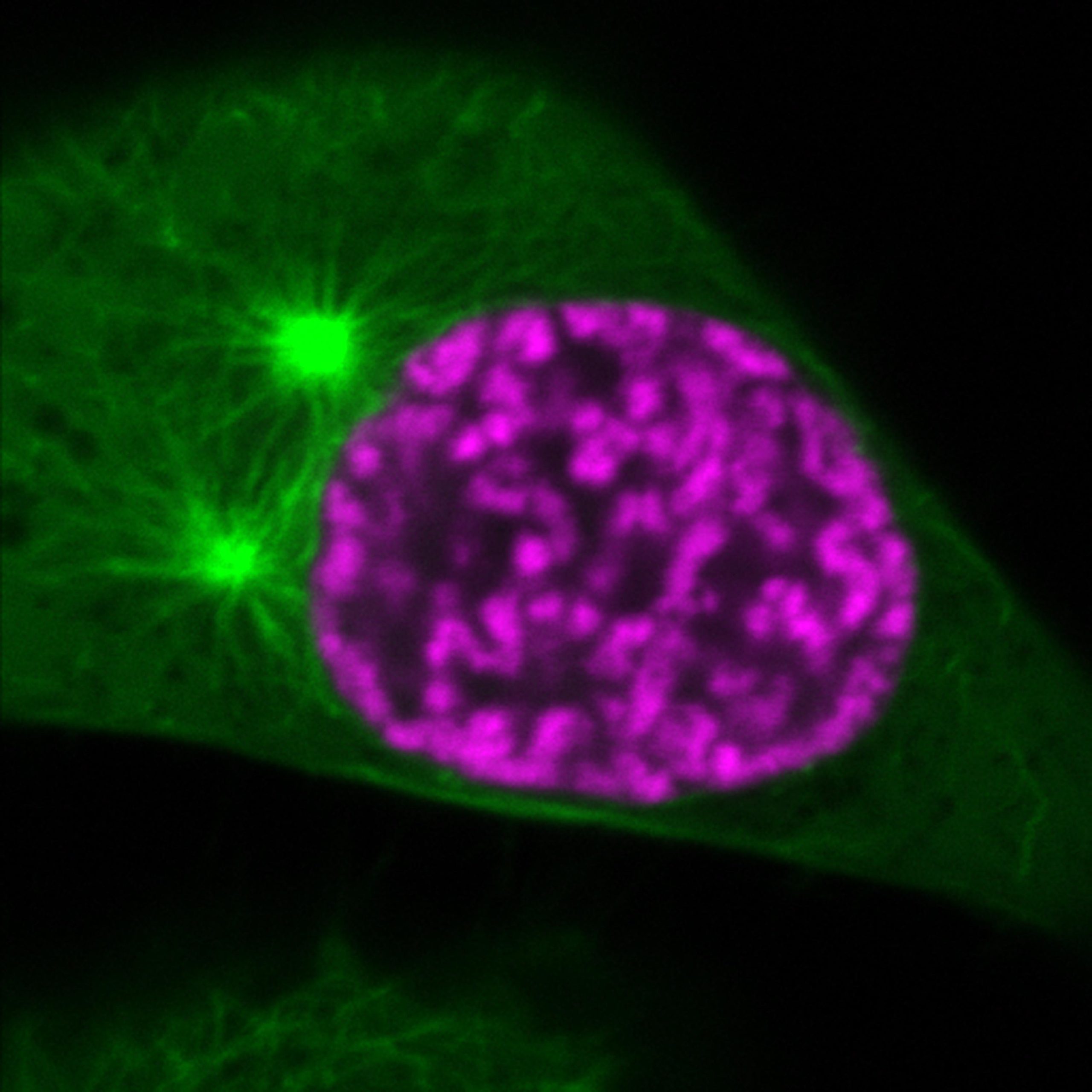 Molecular Mechanism Found That Confers Particular Bodily Properties to Chromosomes in Dividing Human Cells