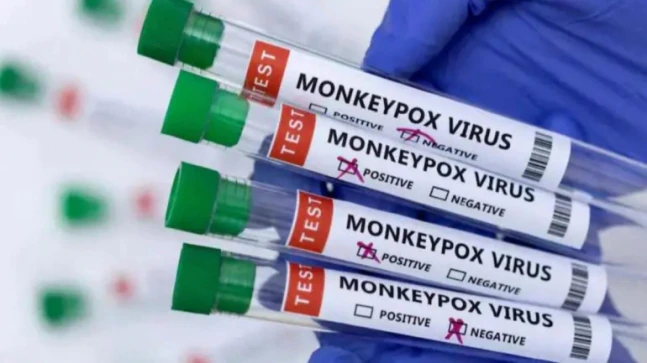 India experiences Ninth monkeypox case as Nigerian girl assessments certain in Delhi