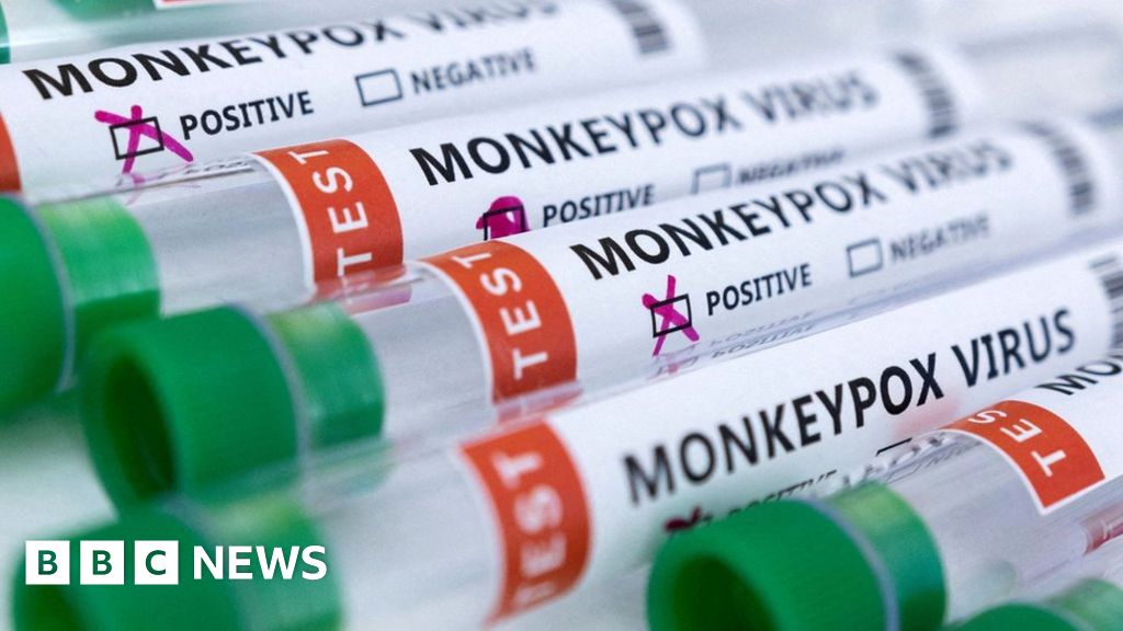 LGBT groups are expecting more motion on monkeypox