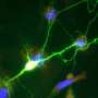 When gentle is the change: Nanometric photodiodes to glance the activity of neurons