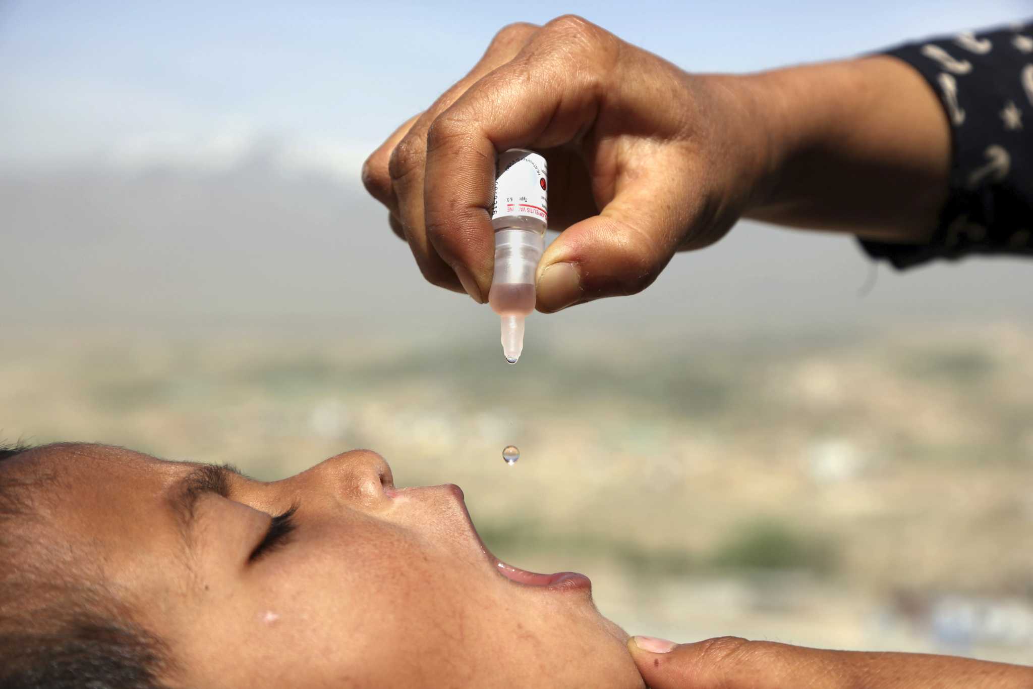 Polio in US, UK and Israel presentations uncommon risk of oral vaccine