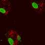 Scientists catch beautiful hyperlink between mitochondrial DNA and increased atherosclerosis threat