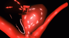 Forecasting Risk of Aneurysm Rupture Based on Blood Flow and Fluid Dynamics